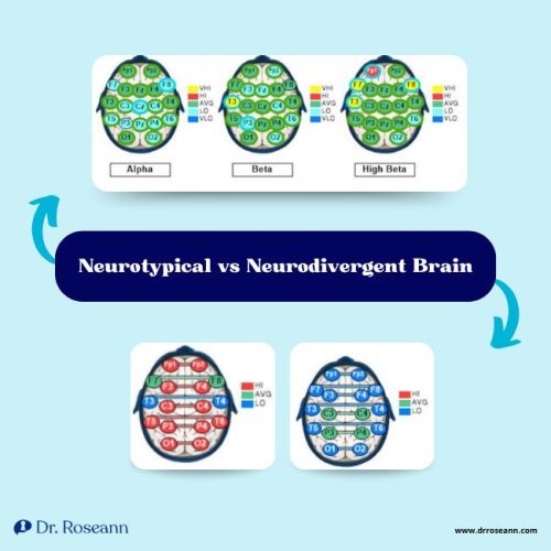 Infographic showing the difference between Neurotypical vs Neurodivergent Brain